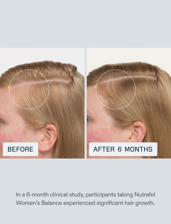 Nutrafol Women Balance Hair Growth Supplement – 120 Capsules (Pack of 2)