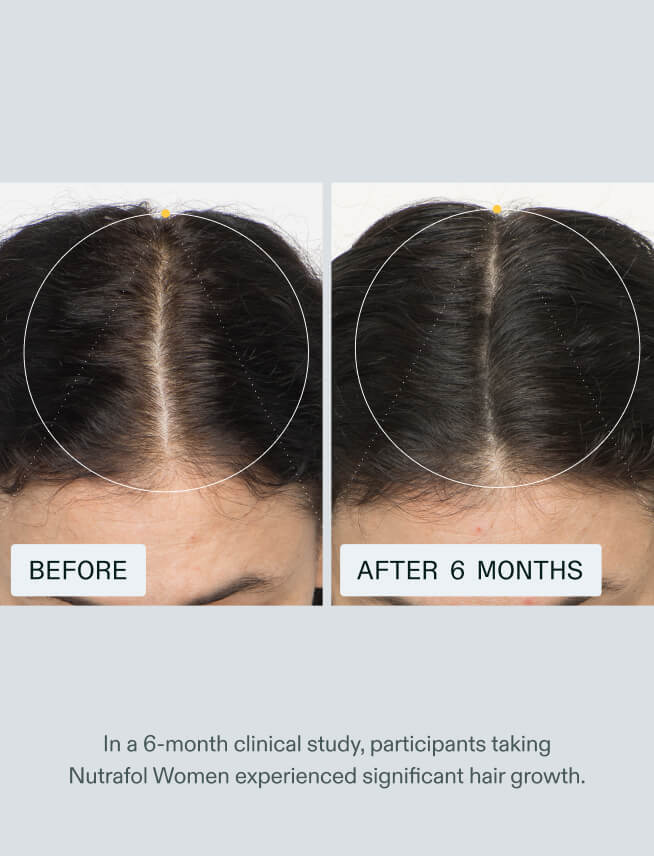 Nutrafol Women's Hair Growth Supplement – 120 Capsules (Pack of 2)